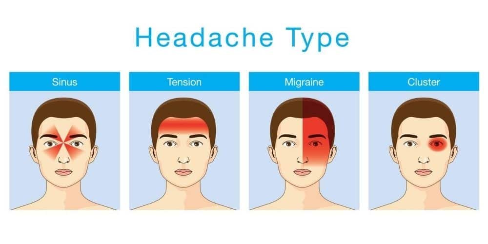 types of headaches